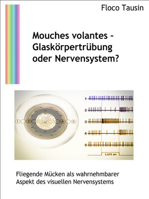 cover image of Mouches volantes--Glaskörpertrübung oder Nervensystem?